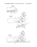 SHOULDER IMMOBILIZER AND FRACTURE STABILIZATION DEVICE diagram and image