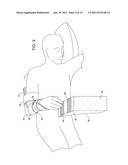 SHOULDER IMMOBILIZER AND FRACTURE STABILIZATION DEVICE diagram and image