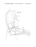 SHOULDER IMMOBILIZER AND FRACTURE STABILIZATION DEVICE diagram and image