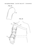 SHOULDER IMMOBILIZER AND FRACTURE STABILIZATION DEVICE diagram and image