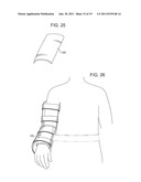 SHOULDER IMMOBILIZER AND FRACTURE STABILIZATION DEVICE diagram and image