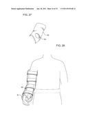 SHOULDER IMMOBILIZER AND FRACTURE STABILIZATION DEVICE diagram and image