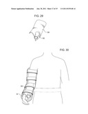 SHOULDER IMMOBILIZER AND FRACTURE STABILIZATION DEVICE diagram and image