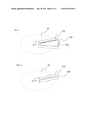 ULTRASONIC CLEANING FLUID, METHOD AND APPARATUS diagram and image