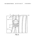 INTEGRAL RETAINER TO RETAIN A SPRING diagram and image