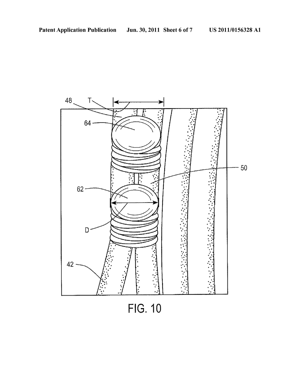 INTEGRAL RETAINER TO RETAIN A SPRING - diagram, schematic, and image 07