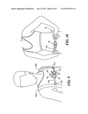 Portable light diagram and image