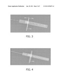 METHOD AND DEVICE FOR ALIGNING A NEEDLE diagram and image