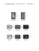 Antisense and pretargeting optical imaging diagram and image