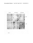 Recombinant alpha-fetoprotein and compositions thereof diagram and image