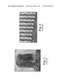 ABRASIVE ARTICLE WITH ARRAY OF GIMBALLED ABRASIVE MEMBERS AND METHOD OF     USE diagram and image