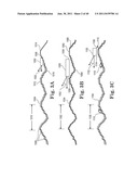 ABRASIVE ARTICLE WITH ARRAY OF GIMBALLED ABRASIVE MEMBERS AND METHOD OF     USE diagram and image