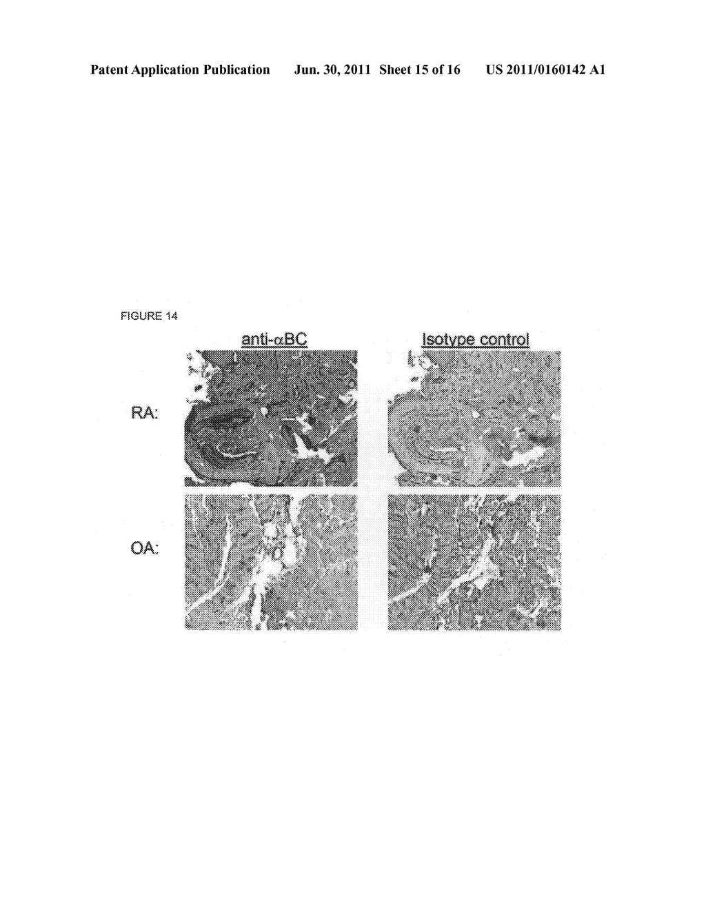 Alpha B-Crystallin as a therapy for inflammation - diagram, schematic, and image 16