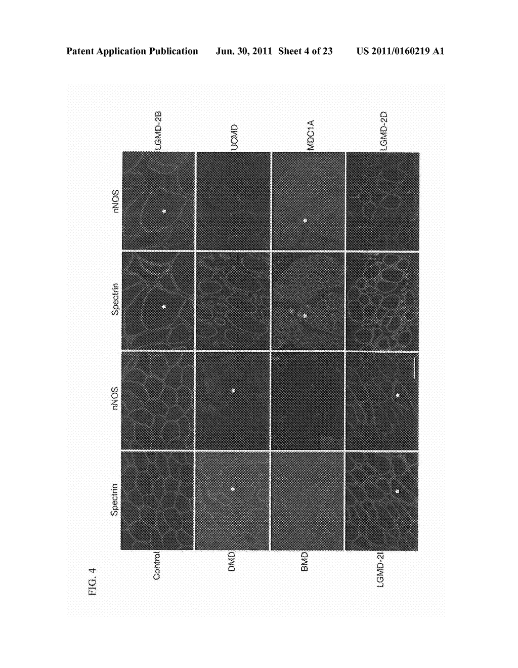 Inhibitors of Phosphodiesterase Type 5A for Treating or Preventing Muscle     Disease or the Symptoms Thereof in a Patient - diagram, schematic, and image 05