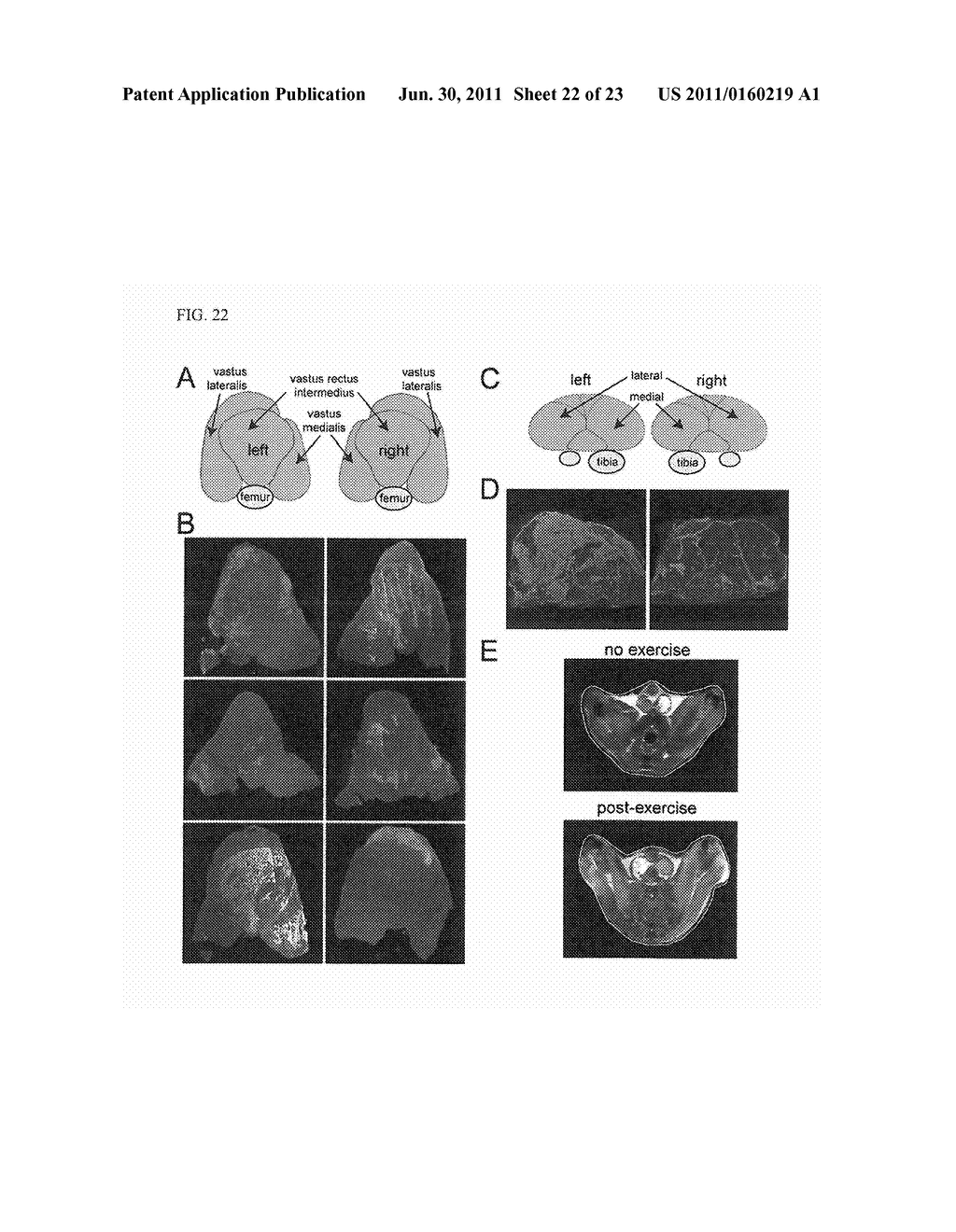 Inhibitors of Phosphodiesterase Type 5A for Treating or Preventing Muscle     Disease or the Symptoms Thereof in a Patient - diagram, schematic, and image 23