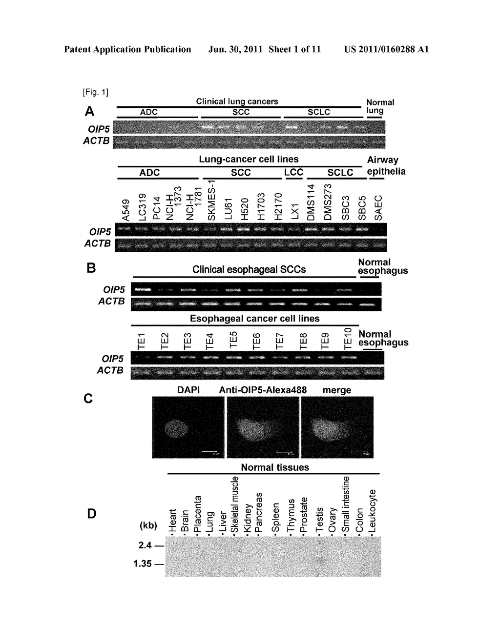 OIP5 AS A TARGET GENE FOR CANCER THERAPY AND DIAGNOSIS - diagram, schematic, and image 02