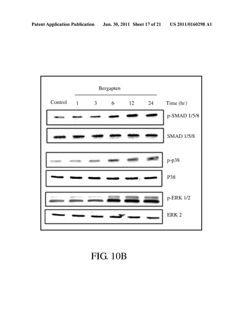 PHARMACEUTICAL COMPOSITION FOR PREVENTION AND/OR TREATMENT OF BONE LOSS - diagram, schematic, and image 18