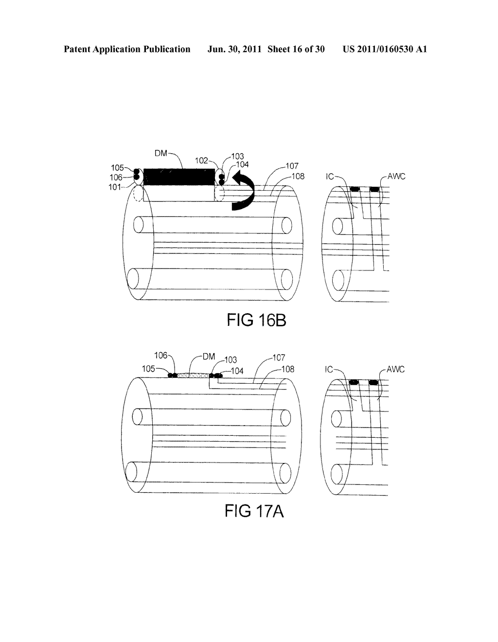 Next Generation Endoscope - diagram, schematic, and image 17