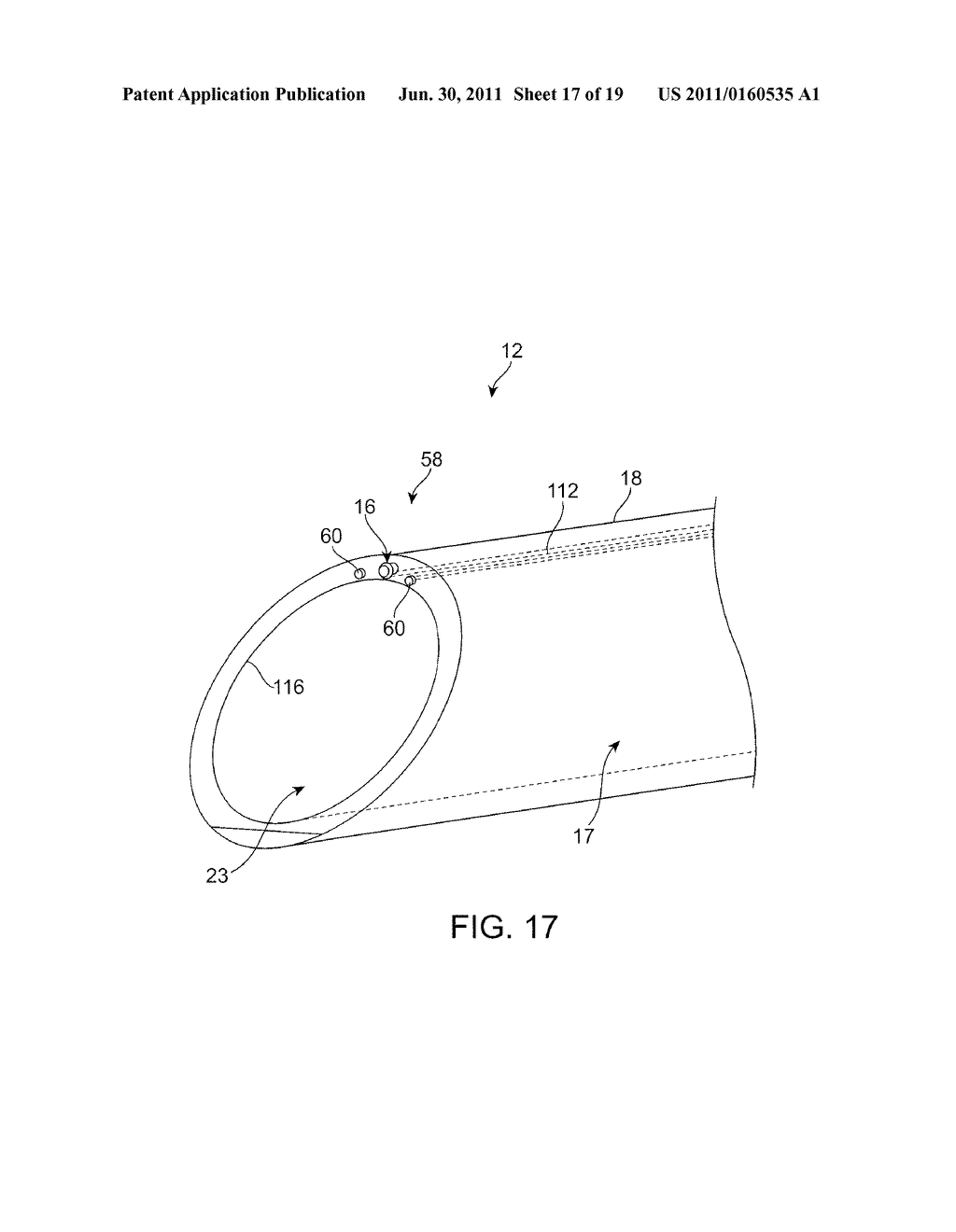 SURGICAL ACCESS PORT WITH EMBEDDED IMAGING DEVICE - diagram, schematic, and image 18