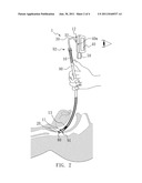 Stylet with a Camera Device diagram and image