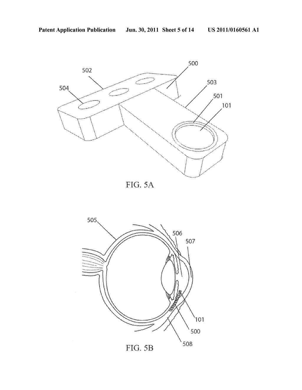 SYSTEM, DEVICE, AND METHOD FOR DETERMINATION OF INTRAOCULAR PRESSURE - diagram, schematic, and image 06