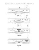 SYSTEMS AND METHODS FOR MULTI-FREQUENCY IMAGING OF PATIENT TISSUE USING     INTRAVASCULAR ULTRASOUND IMAGING SYSTEMS diagram and image