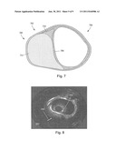 SYSTEMS AND METHODS FOR MULTI-FREQUENCY IMAGING OF PATIENT TISSUE USING     INTRAVASCULAR ULTRASOUND IMAGING SYSTEMS diagram and image