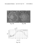 SYSTEMS AND METHODS FOR MULTI-FREQUENCY IMAGING OF PATIENT TISSUE USING     INTRAVASCULAR ULTRASOUND IMAGING SYSTEMS diagram and image