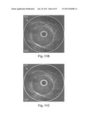 SYSTEMS AND METHODS FOR MULTI-FREQUENCY IMAGING OF PATIENT TISSUE USING     INTRAVASCULAR ULTRASOUND IMAGING SYSTEMS diagram and image