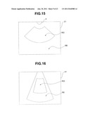 ULTRASOUND IMAGE DISPLAY APPARATUS AND ULTRASOUND IMAGE DISPLAY METHOD diagram and image