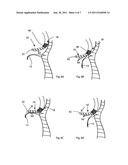 Instrument including a movement sensor and method of using same diagram and image