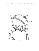 Instrument including a movement sensor and method of using same diagram and image