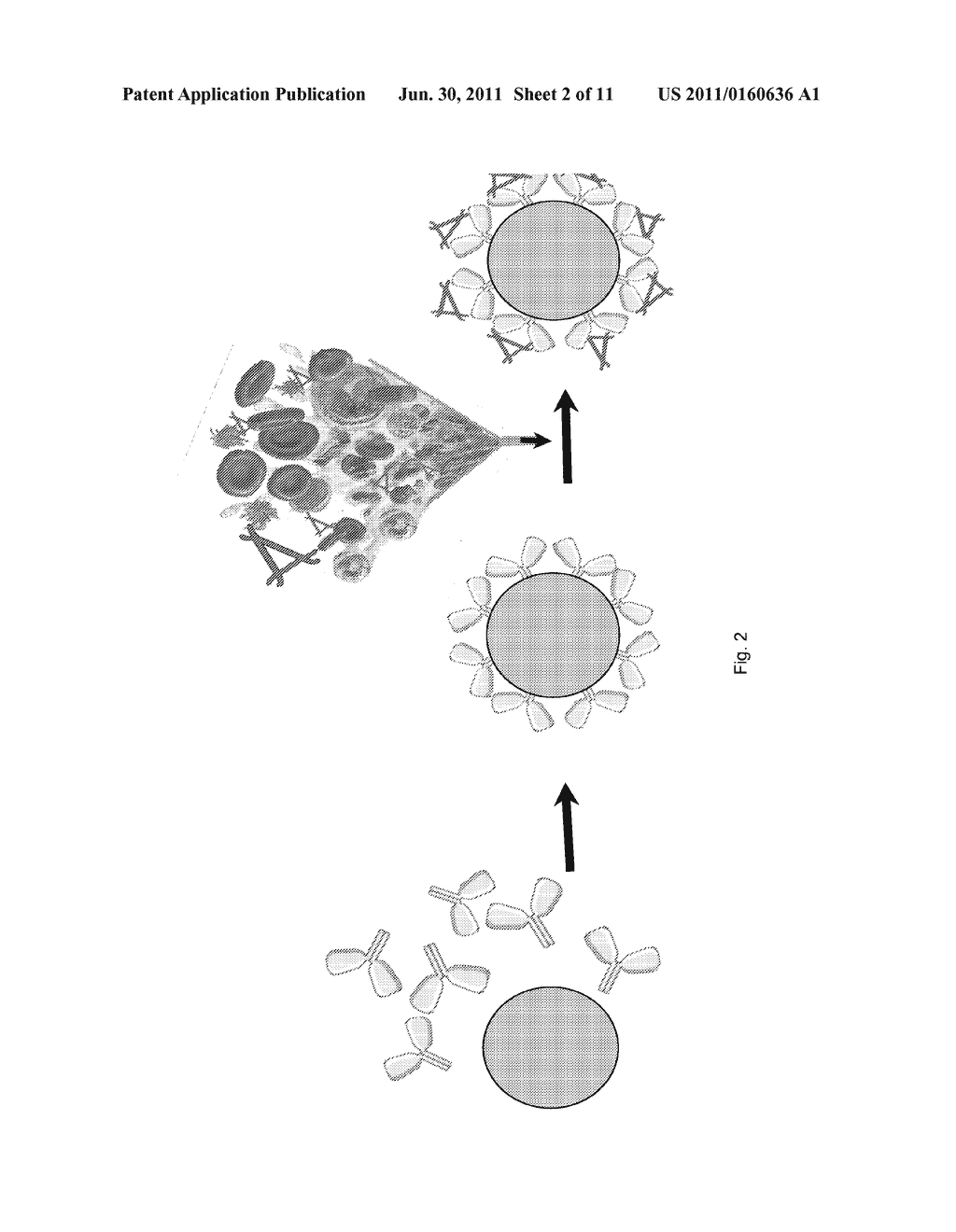 DEVICE AND METHOD FOR INHIBITING COMPLEMENT ACTIVATION - diagram, schematic, and image 03