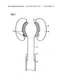 DEVICE FOR STOOL DRAINAGE diagram and image