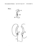 DEVICE FOR STOOL DRAINAGE diagram and image