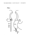 DEVICE FOR STOOL DRAINAGE diagram and image