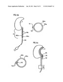 DEVICE FOR STOOL DRAINAGE diagram and image