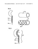 DEVICE FOR STOOL DRAINAGE diagram and image