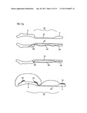 DEVICE FOR STOOL DRAINAGE diagram and image