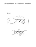 DEVICE FOR STOOL DRAINAGE diagram and image