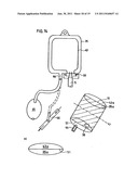 DEVICE FOR STOOL DRAINAGE diagram and image