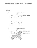 WOUND DRESSING AND METHOD FOR PRODUCING IT diagram and image