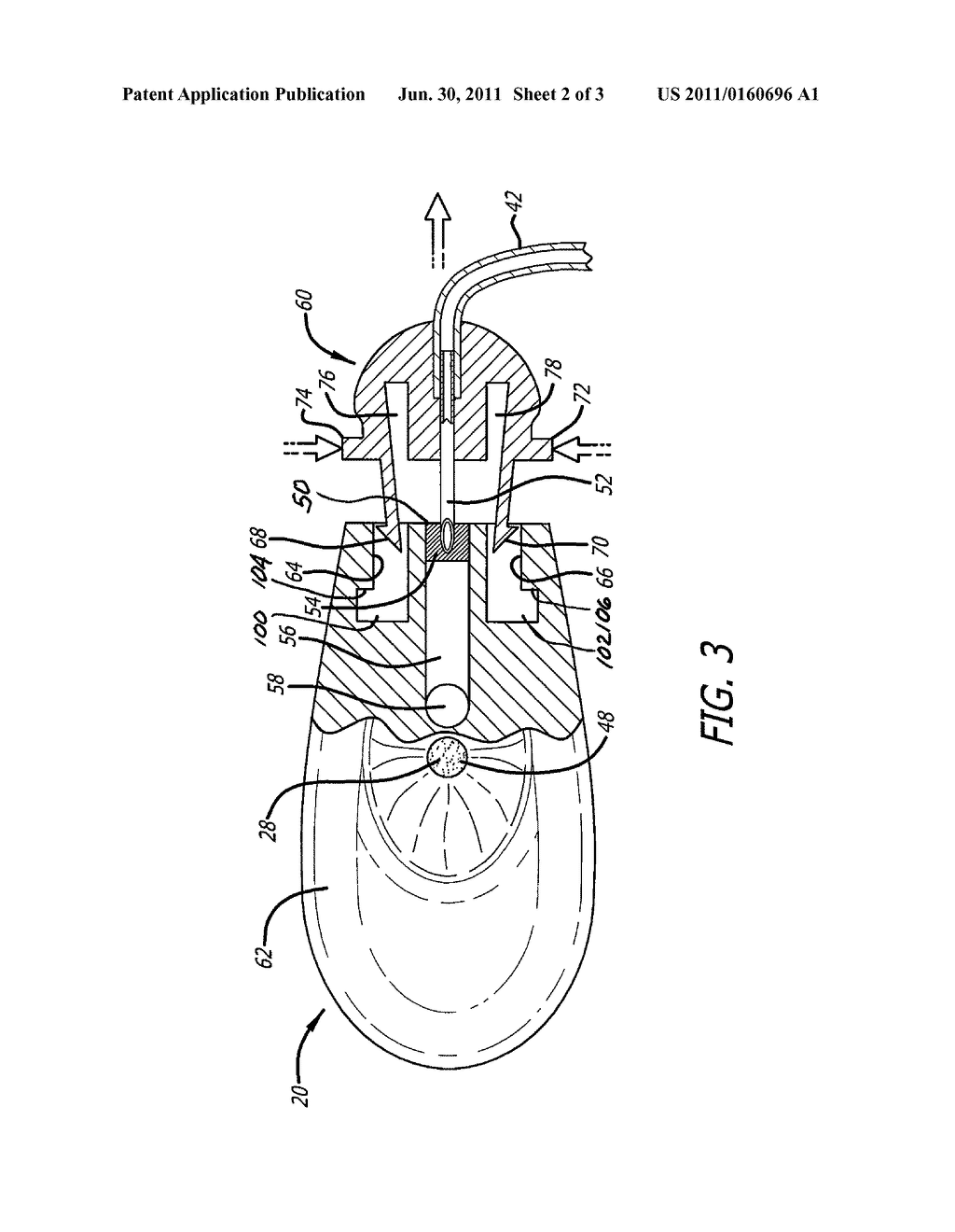 INJECTION PORT DEVICE ADAPTED FOR USE WITH INSULIN PUMP - diagram, schematic, and image 03