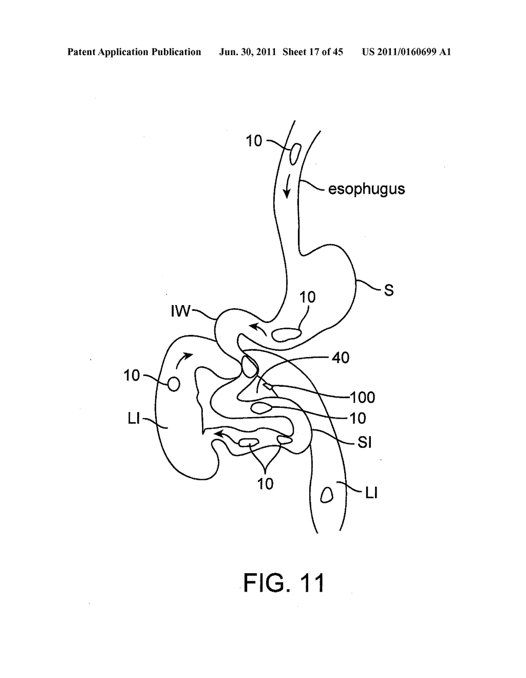 Swallowable Drug Delivery Device and Methods of Drug Delivery - diagram, schematic, and image 18