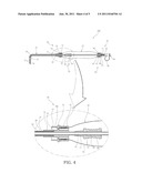 ASEPTIC ADJUSTABLE ASPIRATION CATHETER DEVICE diagram and image