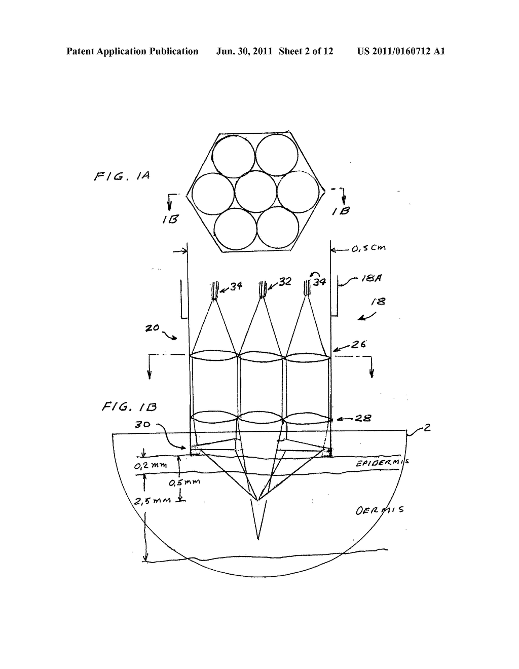 Laser treatment system and method for producing thermal cavities and     energy droplets - diagram, schematic, and image 03