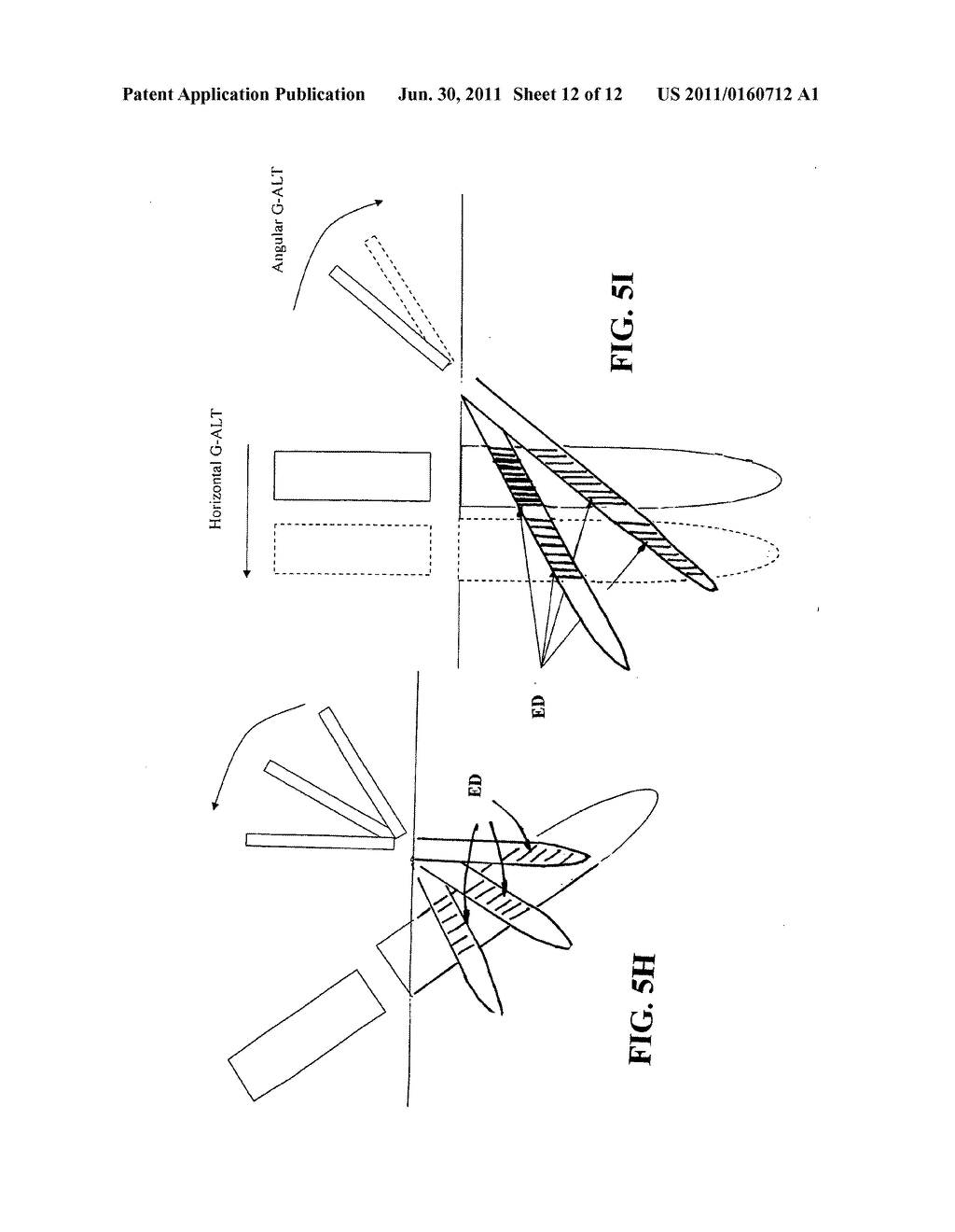 Laser treatment system and method for producing thermal cavities and     energy droplets - diagram, schematic, and image 13