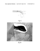 TWISTER FIBER OPTIC SYSTEMS AND THEIR USE IN MEDICAL APPLICATIONS diagram and image