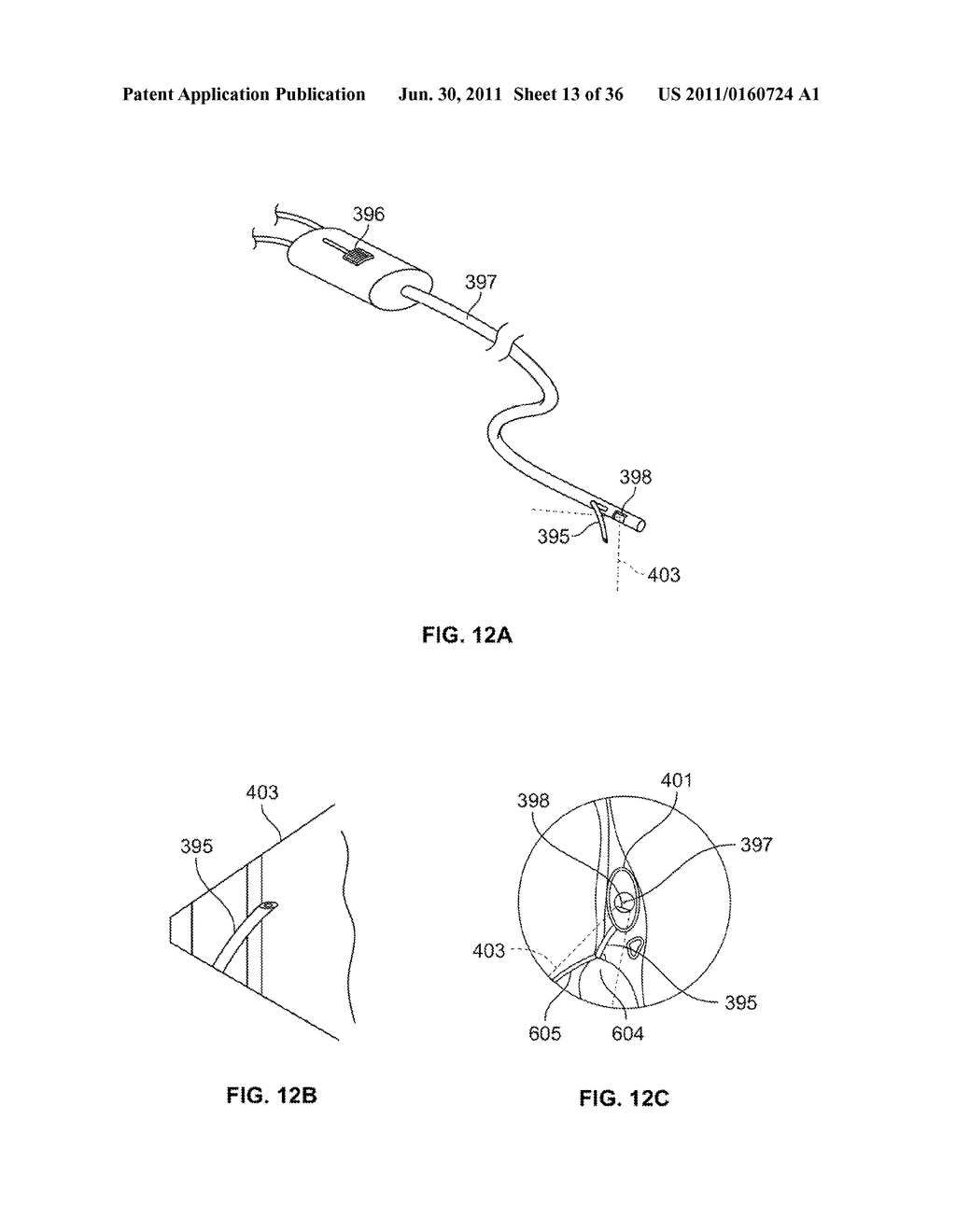 SYSTEM AND METHOD FOR DENATURING AND FIXING COLLAGENOUS TISSUE - diagram, schematic, and image 14