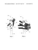 Intramedullary Nail and Protruding Screw Locking Mechanism diagram and image